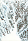 Apoptosis   キャンバスにアクリルペイント  w.14.8×h.21×d.2(cm)  2011